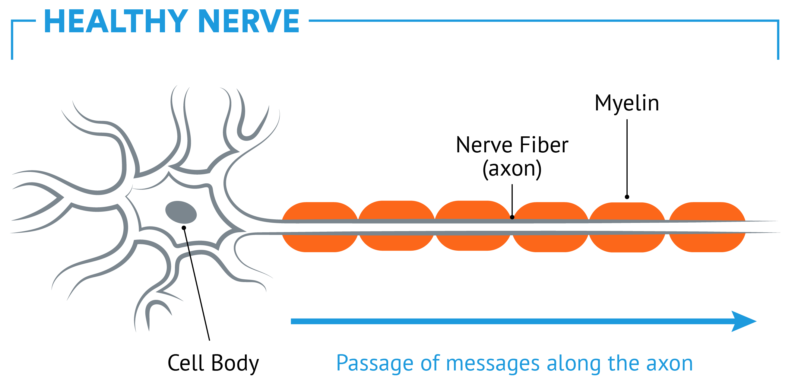 Healthy nerve vs. damaged nerve in CNS